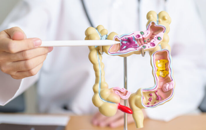 Berufsunfähigkeit Colitis ulcerosa