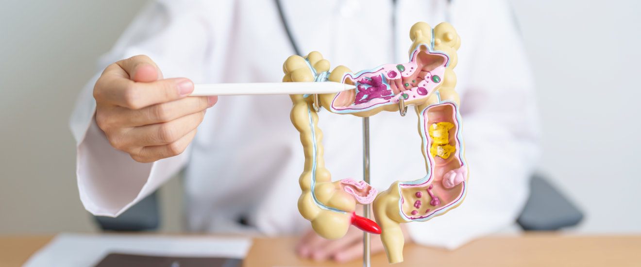 Berufsunfähigkeit Colitis ulcerosa