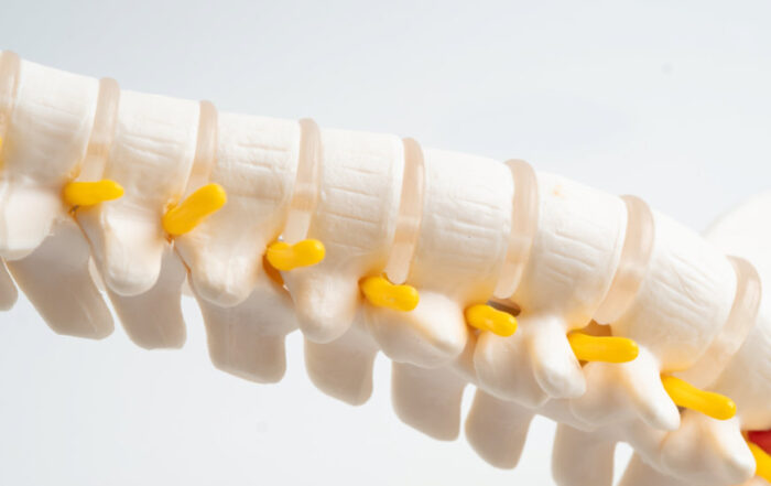 Berufsunfähigkeit bei Spondylarthrose