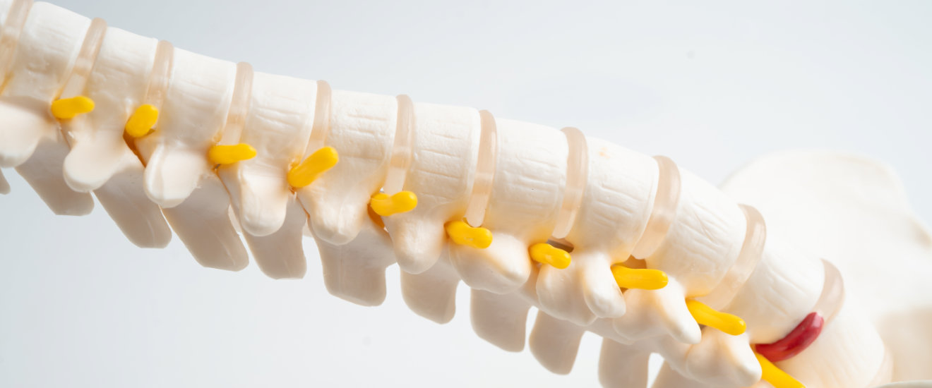 Berufsunfähigkeit bei Spondylarthrose